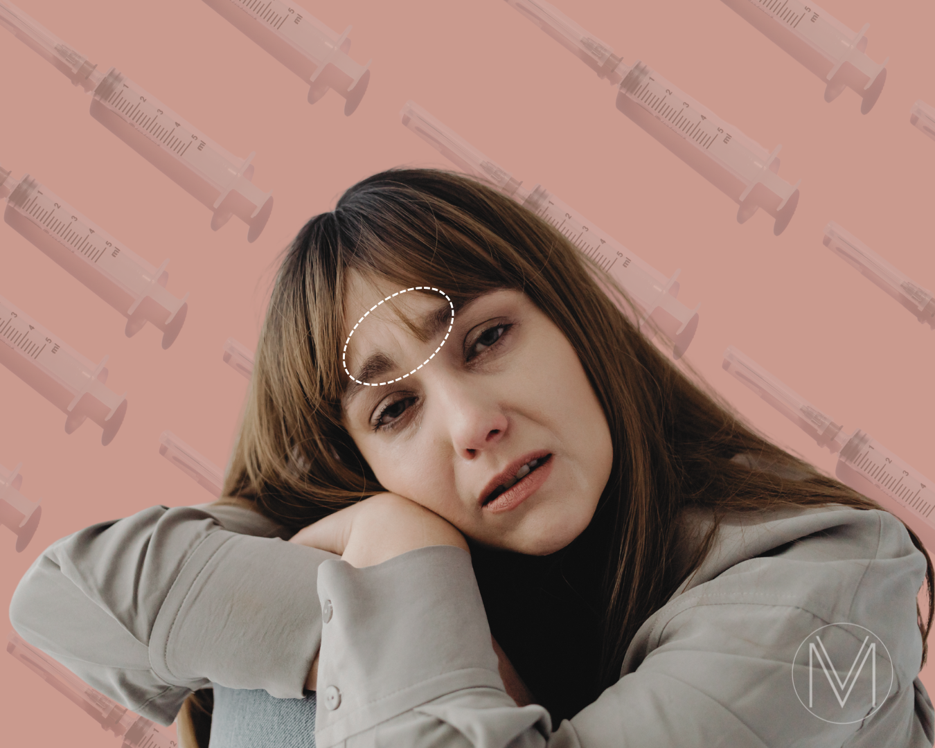 Botox e Depressão