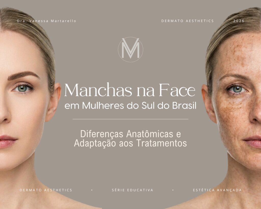 Manchas na Face em Mulheres do Sul do Brasil